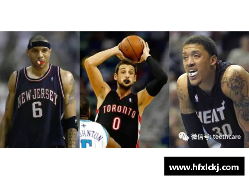 NBA球员的牙套：保护与形象并重